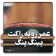 عمر رویه راکت پینگ پنگ و راه های افزایش آن